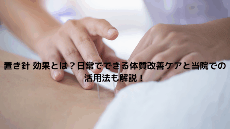 置き針 効果とは？日常でできる体質改善ケアと当院での活用法も解説！