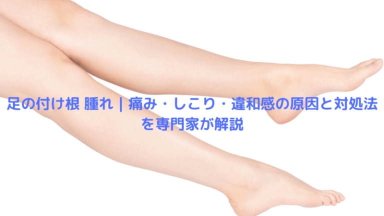 足の付け根 腫れ｜痛み・しこり・違和感の原因と対処法を専門家が解説