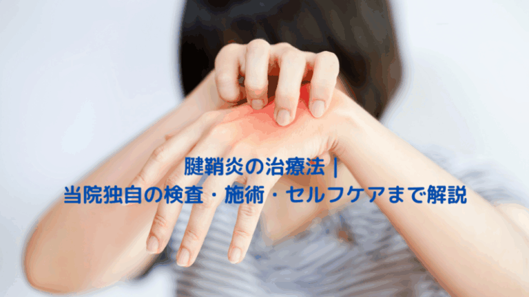 腱鞘炎の治療法｜当院独自の検査・施術・セルフケアまで解説