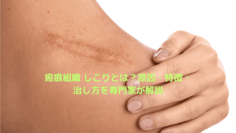 瘢痕組織 しこりとは？原因・特徴・治し方を専門家が解説