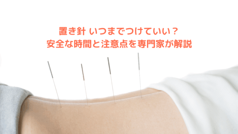 置き針 いつまでつけていい？安全な時間と注意点を専門家が解説