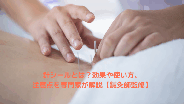 針シールとは？効果や使い方、注意点を専門家が解説【鍼灸師監修】
