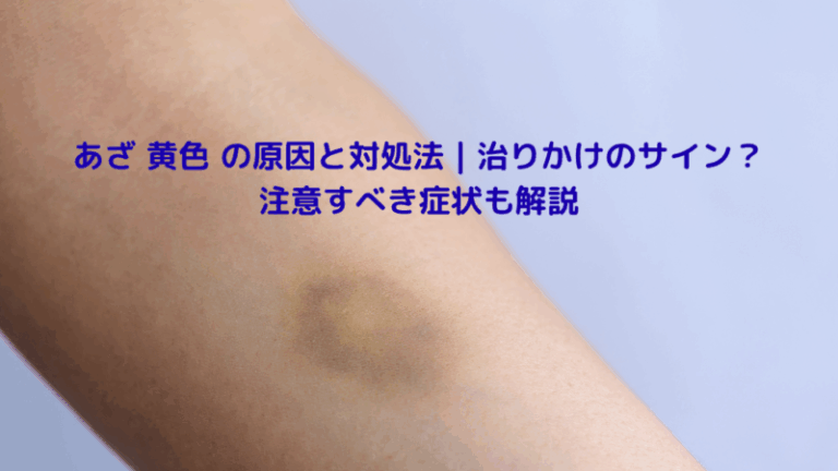 あざ 黄色 の原因と対処法｜治りかけのサイン？注意すべき症状も解説