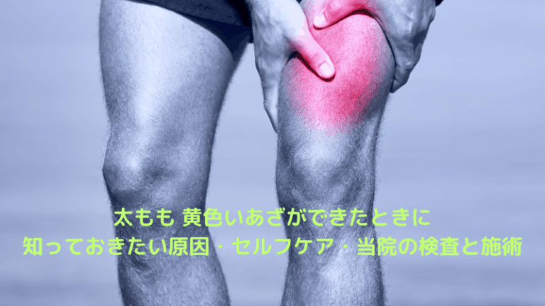 太もも 黄色いあざができたときに知っておきたい原因・セルフケア・当院の検査と施術